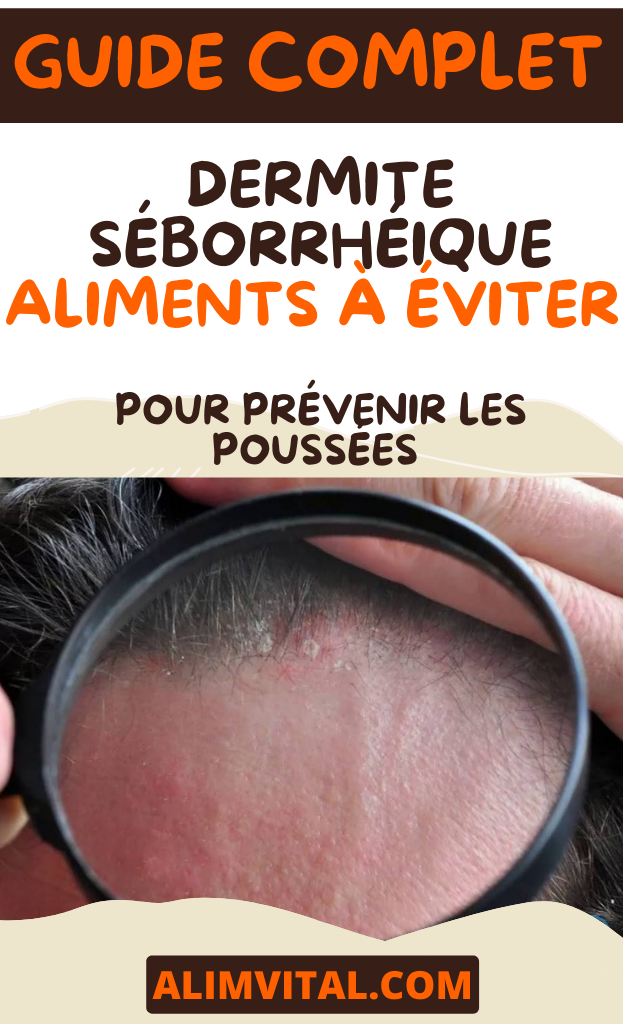 Dermite Séborrhéique : Aliments à Éviter